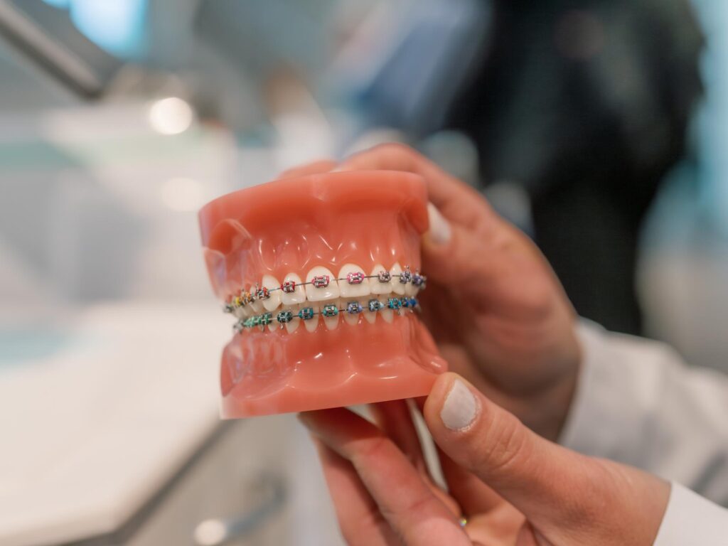 How to Enjoy Summer Foods With Braces Without Breaking a Bracket