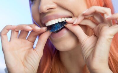 Tips for Transitioning From Braces to Retainers
